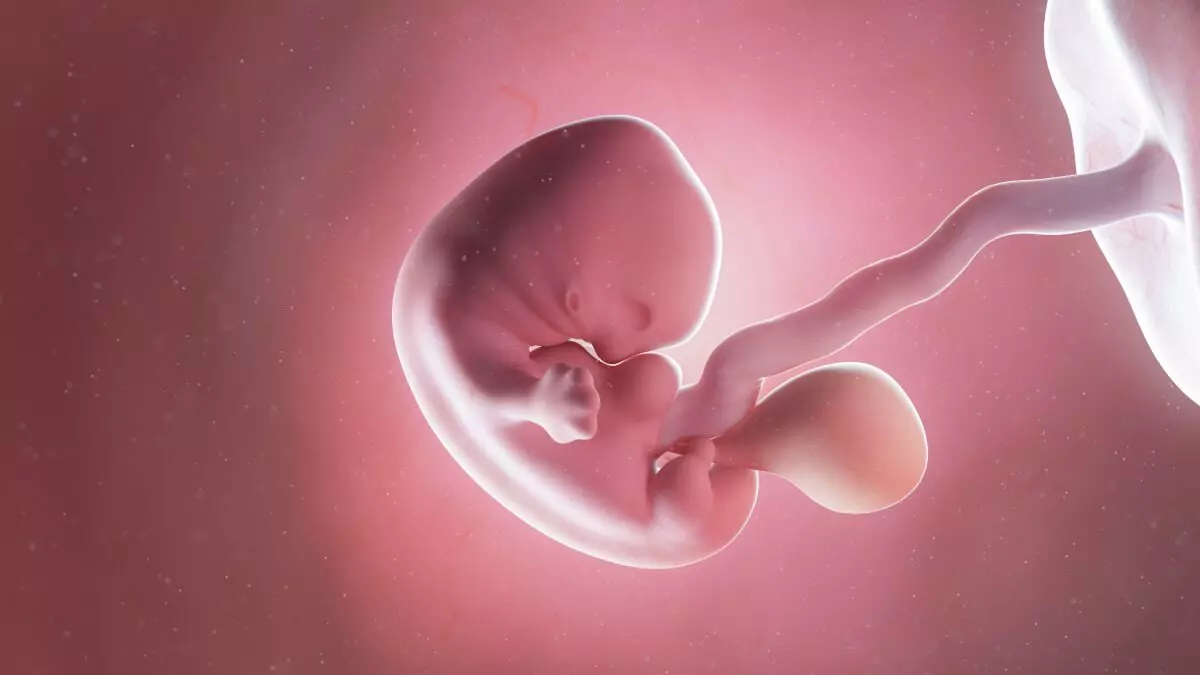 Abortion at 7 Weeks